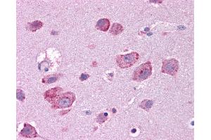 Immunohistochemistry (IHC) image for anti-Hepatocyte Growth Factor (Hepapoietin A, Scatter Factor) (HGF) (N-Term) antibody (ABIN2781817)