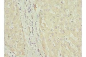 Immunohistochemistry of paraffin-embedded human liver tissue using ABIN7152580 at dilution of 1:100 (FASTK anticorps  (AA 360-549))