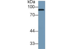 Western Blot; Sample: Human Serum; Primary Ab: 1µg/ml Rabbit Anti-Human CFB Antibody Second Ab: 0.