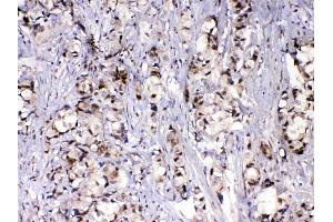 IHC analysis of MED9 using anti-MED9 antibody .
