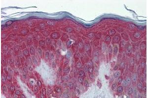 Human Skin: Formalin-Fixed, Paraffin-Embedded (FFPE)
