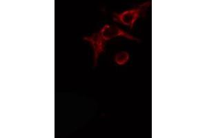 ABIN6274490 staining Hela cells by IF/ICC. (ADPGK anticorps  (Internal Region))