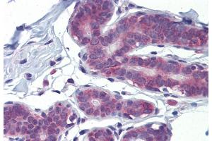 Immunohistochemistry with Human breast tissue at an antibody concentration of 5. (LDOC1 anticorps  (N-Term))