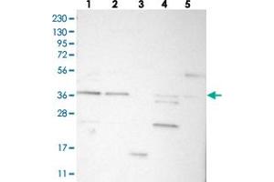Western blot analysis of Lane 1: RT-4, Lane 2: U-251 MG, Lane 3: Human Plasma, Lane 4: Liver, Lane 5: Tonsil with C17orf81 polyclonal antibody  at 1:250-1:500 dilution. (Retinoic Acid Induced 12 (RAI12) anticorps)