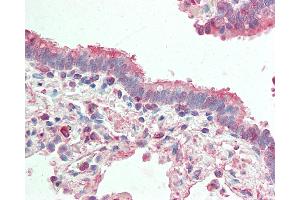 Anti-APG4B / ATG4B antibody IHC staining of human lung, respiratory epithelium. (ATG4B anticorps)