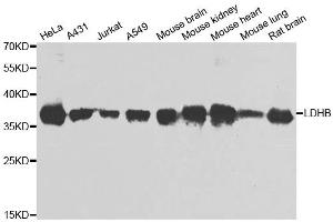 Western blot analysis of extracts of various cell lines, using LDHB antibody. (LDHB anticorps)