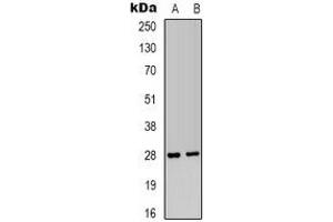 Western blot analysis of IGFBP1 expression in HepG2 (A), MCF7 (B) whole cell lysates. (IGFBPI anticorps)
