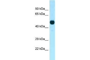 WB Suggested Anti-Cdk14 Antibody Titration: 1.