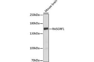 Western blot analysis of extracts of mouse brain, using R antibody (ABIN6132586, ABIN6146718, ABIN6146719 and ABIN6222717) at 1:1000 dilution. (RASGRF1 anticorps  (AA 1-190))