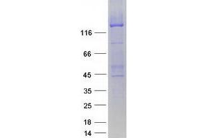 Validation with Western Blot