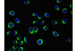Immunofluorescent analysis of A549 cells using ABIN7175846 at dilution of 1:100 and Alexa Fluor 488-congugated AffiniPure Goat Anti-Rabbit IgG(H+L)