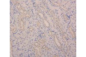 IHC-P analysis of Rat Kidney Tissue, with DAB staining. (Angiopoietin 2 anticorps  (AA 33-243))