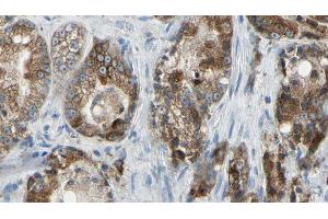 ABIN6277764 at 1/100 staining Human prostate tissue by IHC-P. (Golgin A2 (GOLGA2) (N-Term) anticorps)