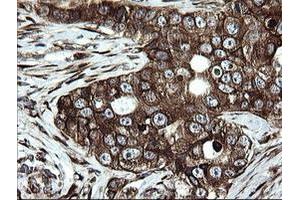 Image no. 3 for anti-Armadillo Repeat Containing 1 (ARMC1) antibody (ABIN1496724) (ARMC1 anticorps)