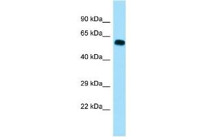 WB Suggested Anti-SGOL1 Antibody Titration: 1. (Shugoshin anticorps  (C-Term))