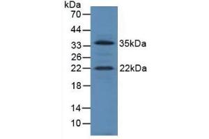 Figure. (IGF1 anticorps  (AA 49-153))