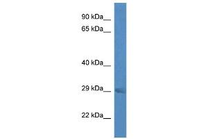 WB Suggested Anti-Rab23 Antibody Titration: 1. (RAB23 anticorps  (Middle Region))