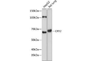 Western blot analysis of extracts of various cell lines, using CRY2 Polyclonal Antibody (ABIN7266526) at 1:1000 dilution.