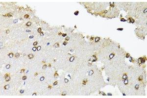Immunohistochemistry of paraffin-embedded Rat brain using POLR2B Polyclonal Antibody at dilution of 1:100 (40x lens).