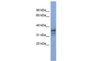 Image no. 1 for anti-RNA Binding Motif Protein 9 (RBM9) (AA 287-336) antibody (ABIN6743007) (RBM9 anticorps  (AA 287-336))