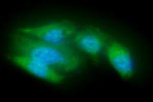 ICC/IF analysis of ACOT8 in A549 cells line, stained with DAPI (Blue) for nucleus staining and monoclonal anti-human ACOT8 antibody (1:100) with goat anti-mouse IgG-Alexa fluor 488 conjugate (Green).