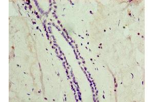 anti-Autophagy related 4C Cysteine Peptidase (ATG4C) (AA 259-458) antibody