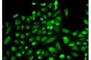 Immunofluorescence analysis of HeLa cells using SPHK1 antibody. (SPHK1 anticorps)