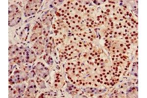 Immunohistochemistry of paraffin-embedded human pancreatic tissue using ABIN7142023 at dilution of 1:100 (AGPAT5 anticorps  (AA 174-313))