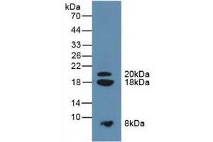Detection of SPINK1 in Mouse Pancreas Tissue using Polyclonal Antibody to Serine Peptidase Inhibitor Kazal Type 1 (SPINK1)