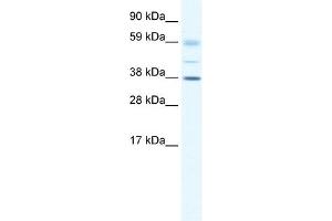 WB Suggested Anti-SOX17 Antibody Titration: 0. (SOX17 anticorps  (C-Term))