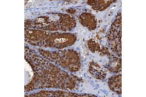 IHC analysis of SBP/SELENBP1 using anti-SBP/SELENBP1 antibody (ABIN7600755). (SELENBP1 anticorps  (AA 23-462))