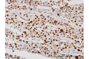 Image no. 4 for anti-serine/threonine Kinase 38 (STK38) (AA 1-466) antibody (ABIN599179) (STK38 anticorps  (AA 1-466))