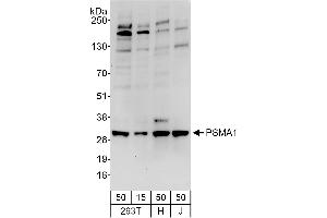 Western Blotting (WB) image for anti-Proteasome Subunit alpha Type 1 (PSMA1) (AA 163-213) antibody (ABIN7454565)