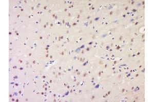 Formalin-fixed and paraffin embedded rat brain labeled with Anti-NSD1 Polyclonal Antibody, Unconjugated  at 1:200 followed by conjugation to the secondary antibody and DAB staining. (NSD1 anticorps  (AA 2401-2600))