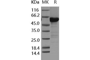 Western Blotting (WB) image for Mitogen-Activated Protein Kinase Kinase 6 (MAP2K6) (Active) protein (GST tag,His tag) (ABIN7317108) (MAP2K6 Protein (GST tag,His tag))