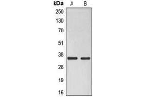 Western blot analysis of ELOVL6 expression in Raji (A), HuvEc (B) whole cell lysates.