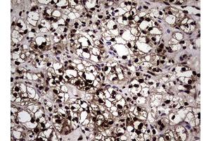 Image no. 14 for anti-Nibrin (NBN) (AA 183-460) antibody (ABIN1491058)