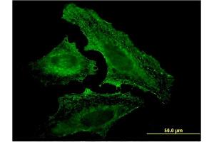Immunofluorescence of monoclonal antibody to UVRAG on HeLa cell.
