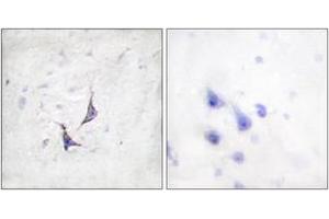 Immunohistochemistry analysis of paraffin-embedded human brain tissue, using Syndecan4 (Ab-179) Antibody.