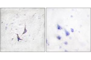 Immunohistochemistry analysis of paraffin-embedded human brain tissue, using Syndecan4 (Ab-179) Antibody. (SDC4 anticorps  (AA 145-194))