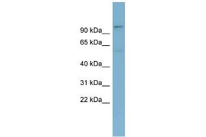 WB Suggested Anti-TBL3 Antibody Titration: 0. (TBL3 anticorps  (N-Term))