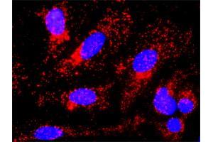 Proximity Ligation Analysis of protein-protein interactions between GSK3B and CTNNB1.
