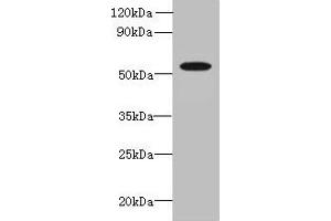 Western blot All lanes: L2HGDH antibody at 8 μg/mL + K562 whole cell lysate Secondary Goat polyclonal to rabbit IgG at 1/10000 dilution Predicted band size: 51, 49 kDa Observed band size: 51 kDa (L2HGDH anticorps  (AA 52-463))
