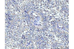 anti-threonyl-tRNA Synthetase 2, Mitochondrial (TARS2) (AA 69-718) antibody