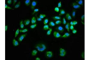 Immunofluorescence staining of Hela cells(treated with 100 mM EGF for 20 min) with ABIN7127677 at 1:68,counter-stained with DAPI. (Recombinant AKT1 anticorps  (pSer473))