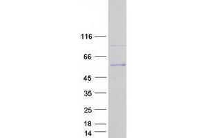 Validation with Western Blot