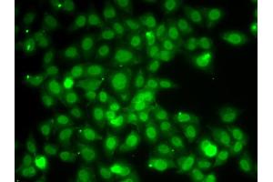 Immunofluorescence analysis of A549 cells using TRAF4 antibody. (TRAF4 anticorps)