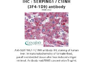 Image no. 1 for anti-Serpin Peptidase Inhibitor, Clade G (C1 Inhibitor), Member 1 (SERPING1) (AA 1-501), (full length) antibody (ABIN1723814)