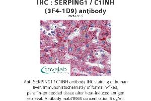 Image no. 1 for anti-Serpin Peptidase Inhibitor, Clade G (C1 Inhibitor), Member 1 (SERPING1) (AA 1-501), (full length) antibody (ABIN1723814) (SERPING1 anticorps  (full length))