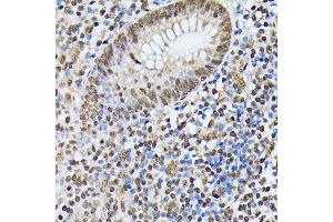 Immunohistochemistry of paraffin-embedded human appendix using hnRNPM antibody (ABIN6128031, ABIN6141919, ABIN6141920 and ABIN6222681) at dilution of 1:100 (40x lens). (HNRNPM anticorps  (AA 491-730))